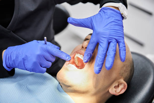Best Emergency Dentist for Lost Fillings or Crowns in Richwood, LA